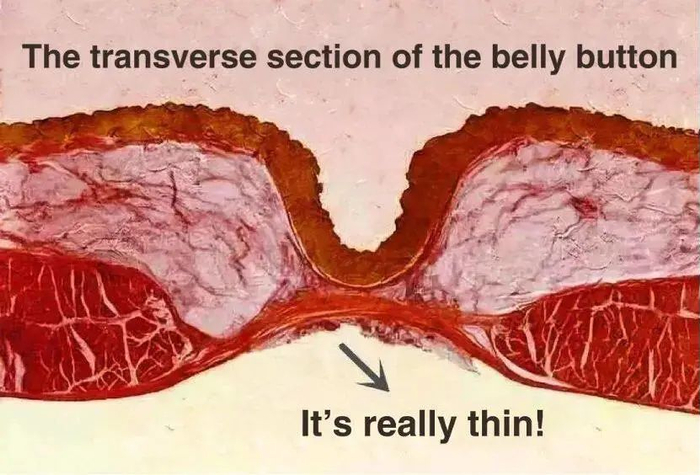 腹部横切解剖图