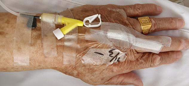 留置针怎么贴膜该怎么拯救你:被“强拉硬拽”的留置针?_新闻资讯_第3张_活检穿刺产品网 留置针怎么贴膜该怎么拯救你:被“强拉硬拽”的留置针?_https://www.jmylbn.com_新闻资讯_第3张