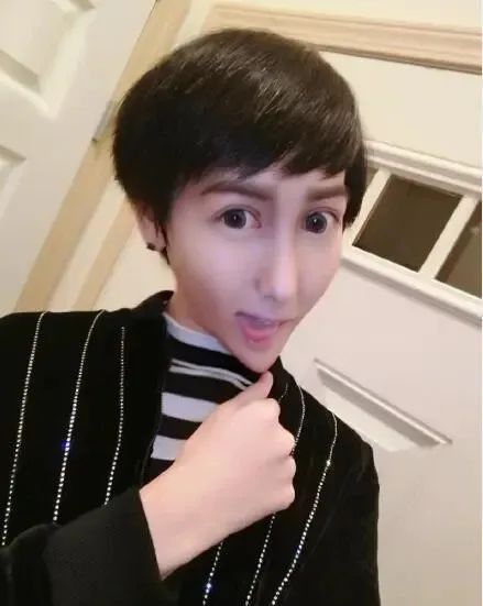 还记得蛇精脸网红刘梓晨吗?如今大变样完全认不出!