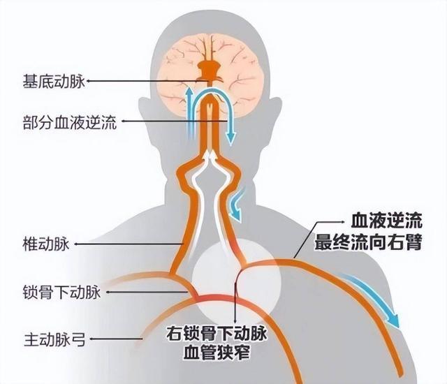 颈总动脉分支图片