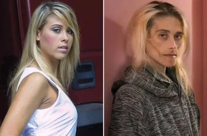 对弟弟充满敌意的厌食症女孩|厌食症|骨瘦如柴|艾伦_新浪新闻