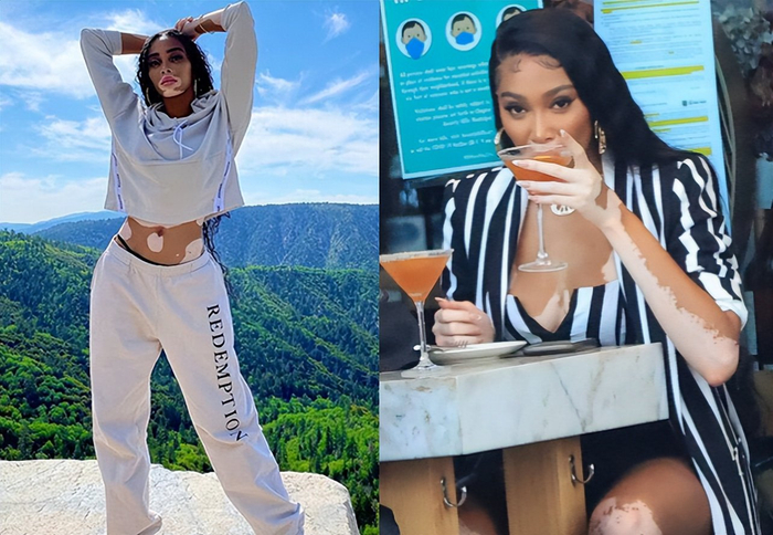 库兹马女友深夜外出,穿吊带网裙秀身材,若隐若现!