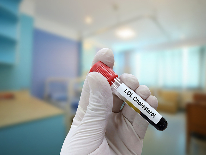 用于低密度脂蛋白胆固醇测试的血样。视觉中国  图