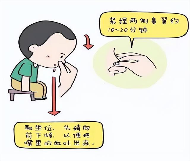 为什么老流鼻血？