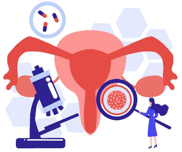 宫颈癌筛查 卡通图片