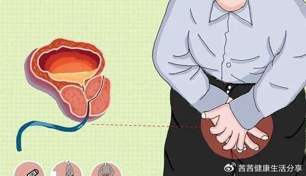 揭示淋菌性尿道炎有效诊疗方案|尿道炎|淋菌性|抚州_新浪新闻