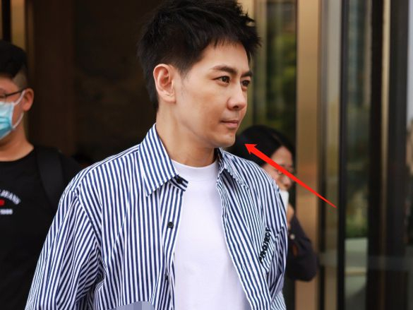 林志颖近照曝光脸歪嘴斜腿瘦如麻杆整容痕迹明显老到不敢认