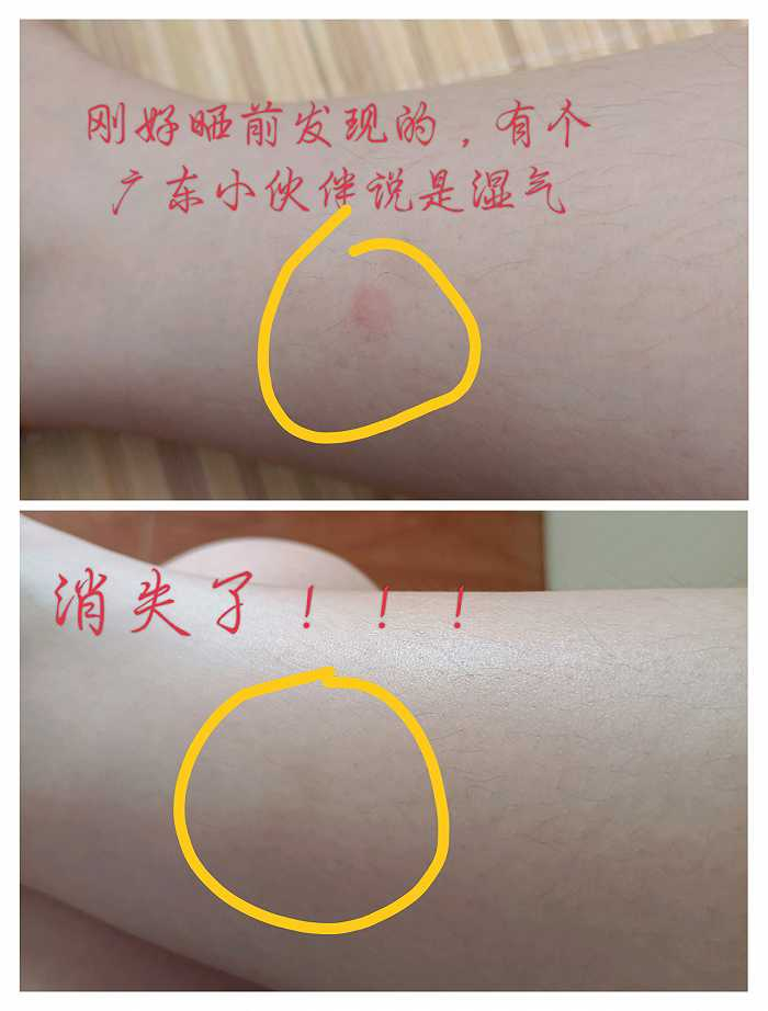 晒背后，体内湿气被“晒”走了。图 / 受访者提供