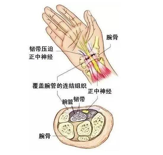 当你的手出现这些异样或是腕管综合征