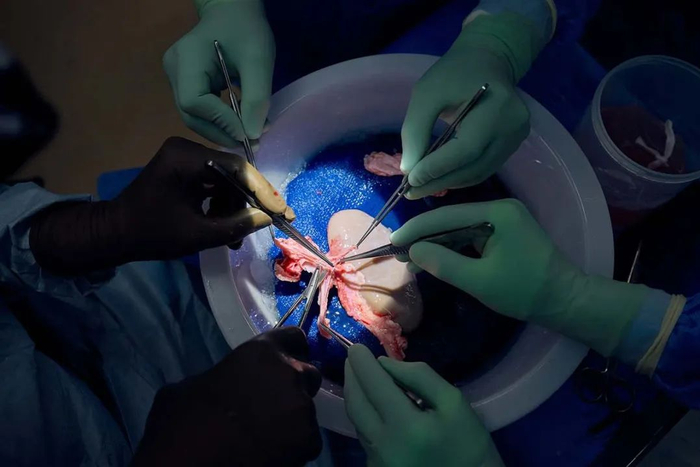 纽约大学朗格健康中心团队正在准备待移植猪肾。/NYU langone