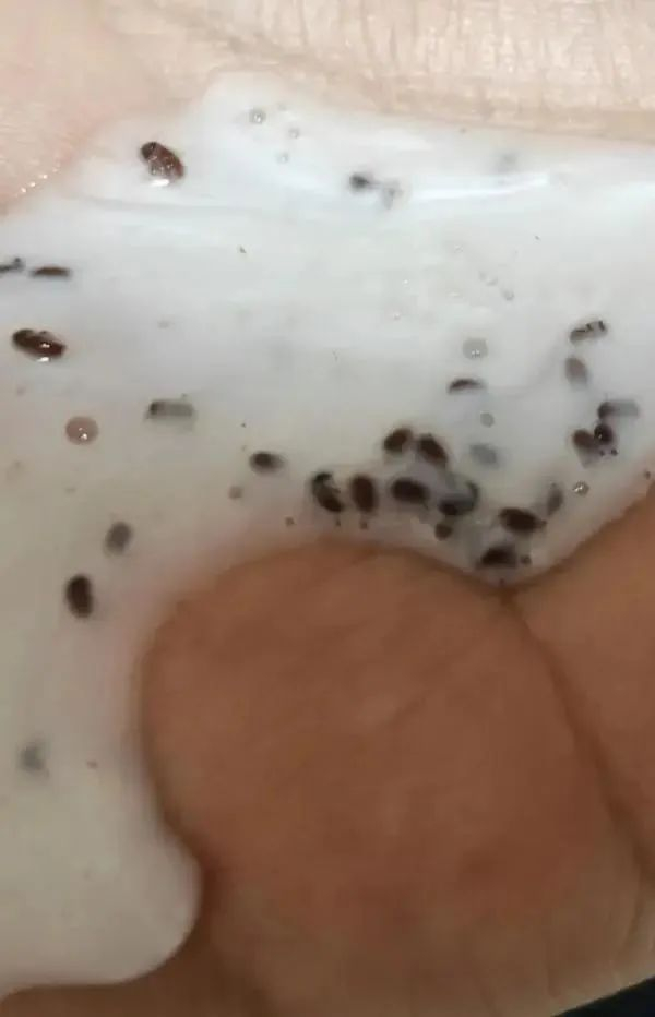 海飞丝洗发水中的不明物质。赵女士供图