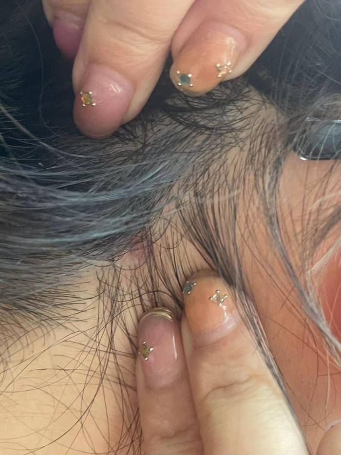 头皮红肿发痒（图片由胡女士提供）