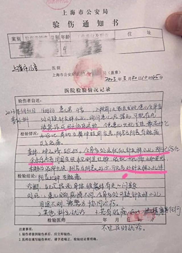 上海幼儿园幼童疑遭虐待 身上有小孔（上海幼儿园杀童案）