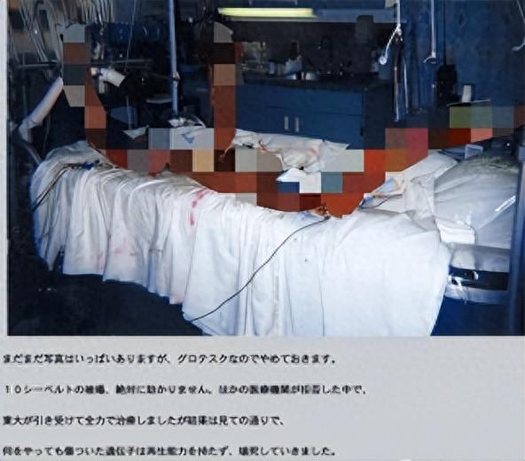 日本核辐射有多恐怖?工人被辐射,眼看着自己腐烂,83天堪比凌迟