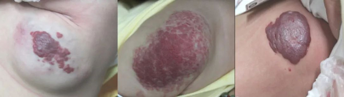 中南大学湘雅三院 图