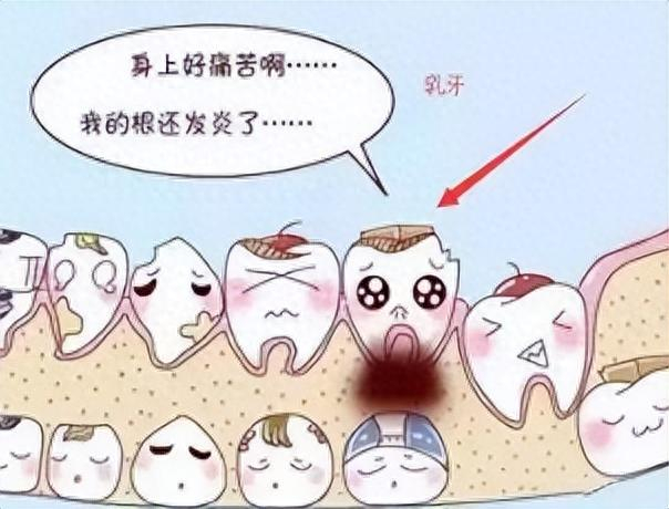 乳牙龋坏影响一生如何保护孩子的乳牙这份护牙干货快收好