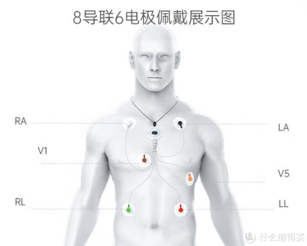 三个心电贴位置图片