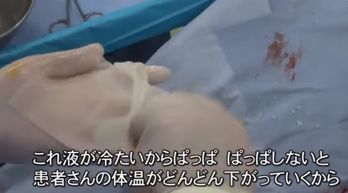 上田敬博之后又用这种方法治愈了其他病人