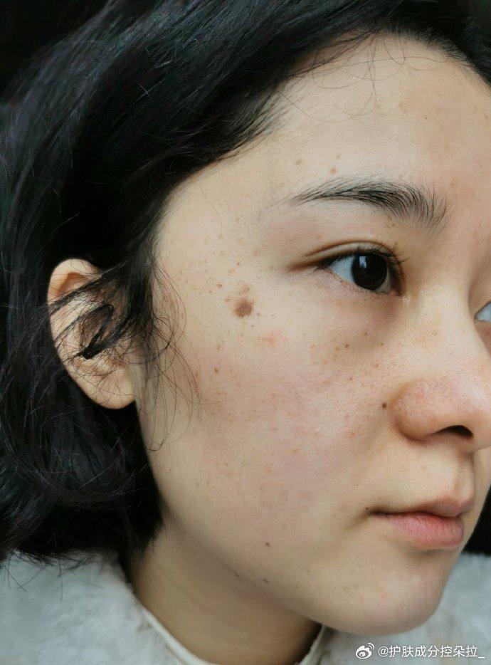投稿：宝宝们，我来啦！一个月后，我们再次相见，汇报一下情况……