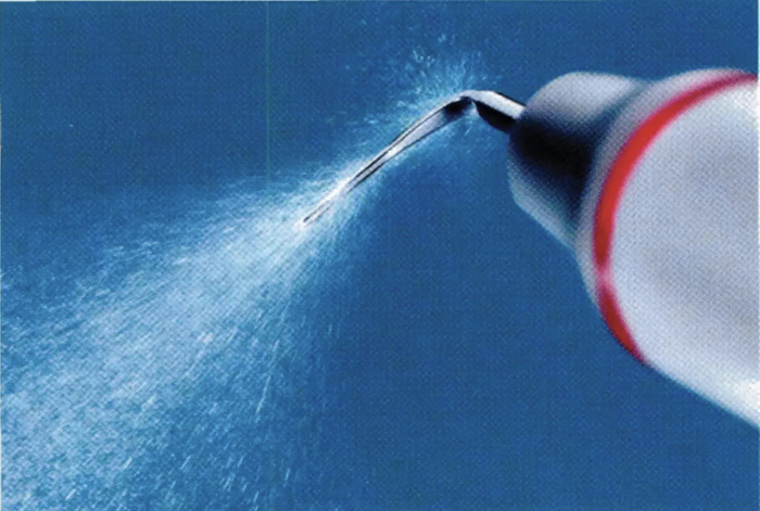 洗牙是牙周治疗最基础的操作，图源：孟焕新. 牙周病学（第5版）. 北京: 人民卫生出版社. 2020