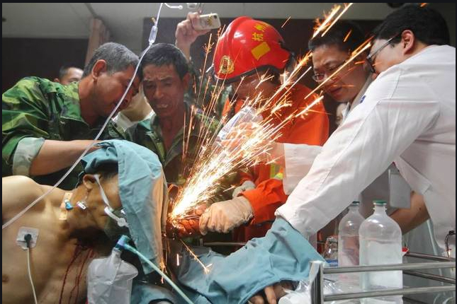 图片说明：2012年，福建一名电焊工被7根钢筋插透。图片来源/受访者提供、都市快报拍摄