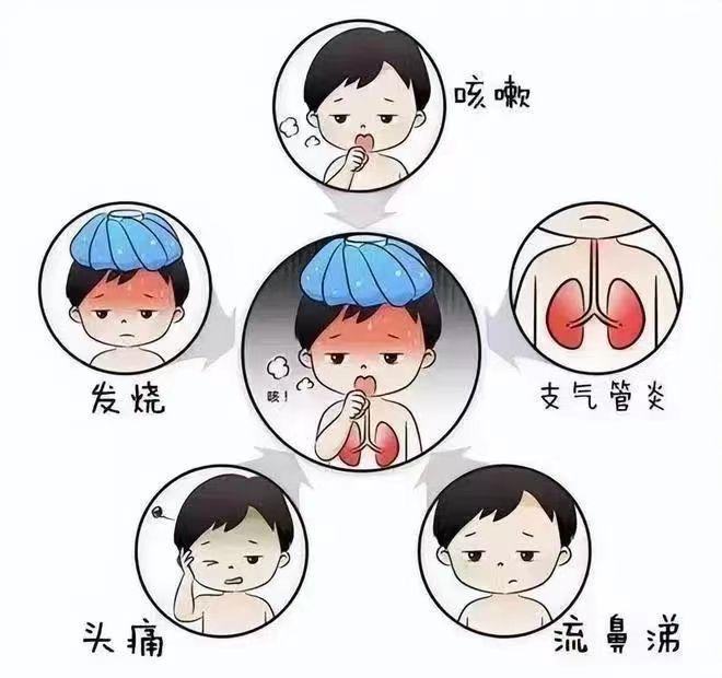 吸入性肺炎症状 新浪网