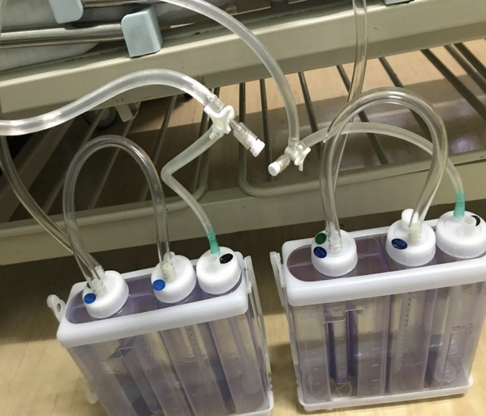 应用在低负压吸引胸腔闭式引流瓶压力调节通过集团新技术新项目的申报