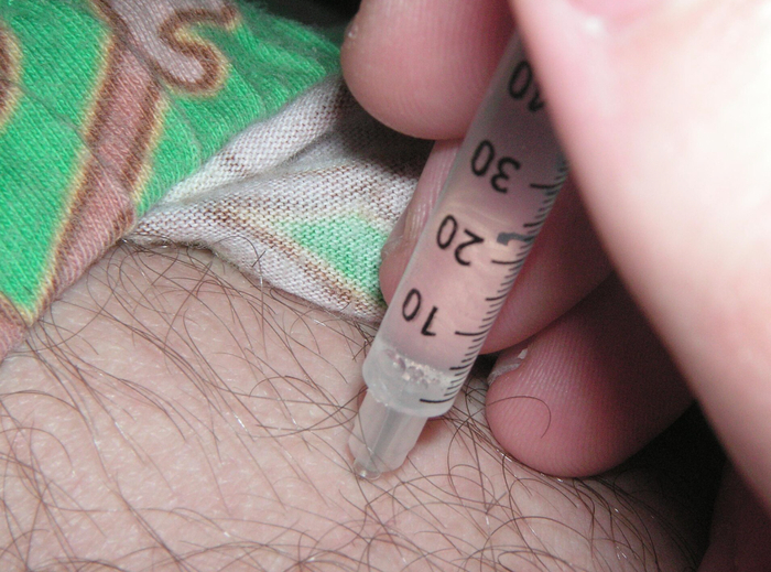 肌肉注射，图片来源：wikimedia