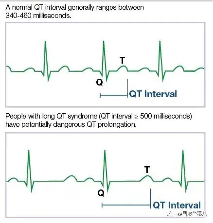 （健康人心电图与该病患者心电图的Q-T间隔对比）