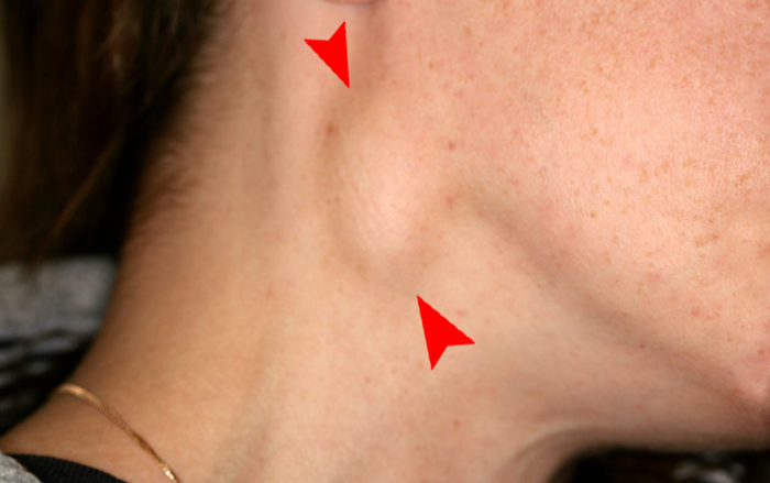 图片来源：网络