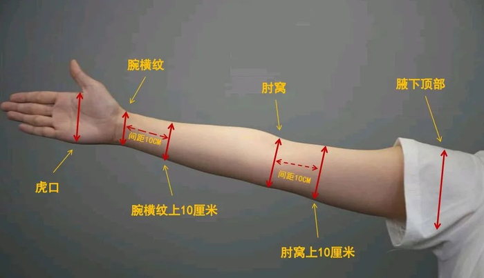 上肢臂围该如何测量?|上肢|上臂|水肿_新浪新闻