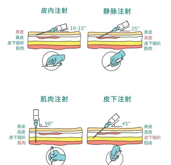 皮内注射图片卡通图片