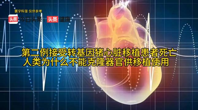 美国第二例接受转基因猪心脏移植患者死亡