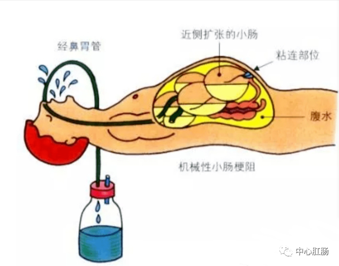 无痛胃管置管术到底是什么?本护士都惊呆了!