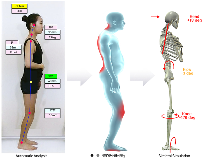 美人在骨骨相美体矫姿塑形