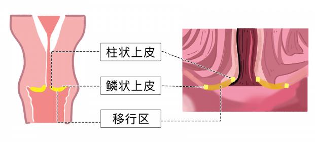 鳞柱交界可见图片