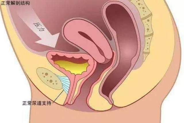 尿道下垂火针与艾灸治疗|尿道|艾灸|膀胱下垂_新浪新闻