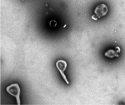 电子显微镜下的肺炎支原体▽相比起来,支原体和细菌更相似,只是没有