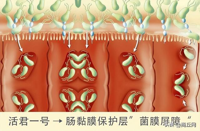 潰瘍性腸炎,結腸炎,直腸炎的