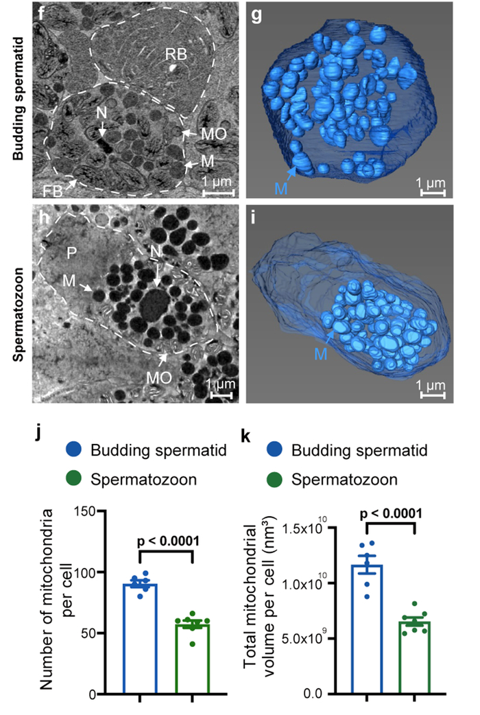 西湖大学新研究:发现全新细胞结构,对精子活性至关重要|西湖大学_新浪