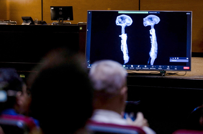 听证会的屏幕上展示的X光片视频。