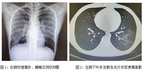 财经肺炎（肺炎你搞错了） 财经肺炎（肺炎你搞错了）《财经意思》 财经新闻