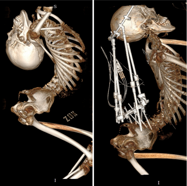 姜延琛第一次手术前后的CT扫描图对比