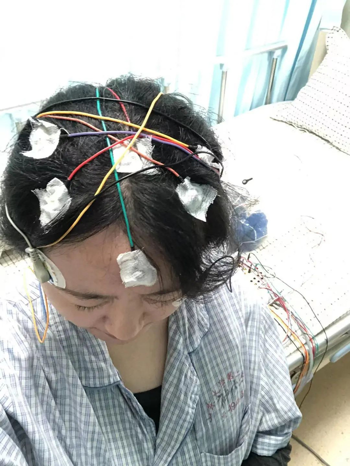 ▲史嘉茵接受小睡试验，头部贴满电极。受访者供图