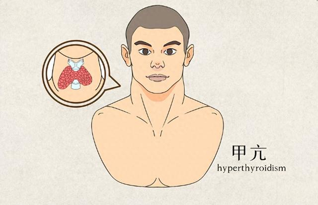 察颜观色可辨这些疾病,教你怎么看|二尖瓣狭窄|疾病|面容_新浪新闻