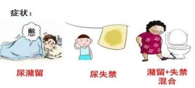 女子突发脊髓炎神经受损致尿潴留,中医康复解决排尿困难之"急"|中医