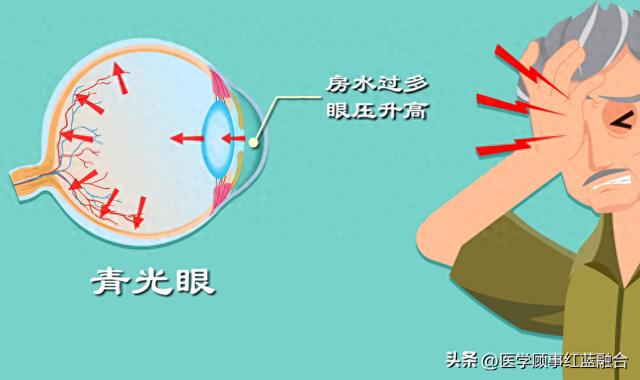 明明是青光眼為何要做白內障手術