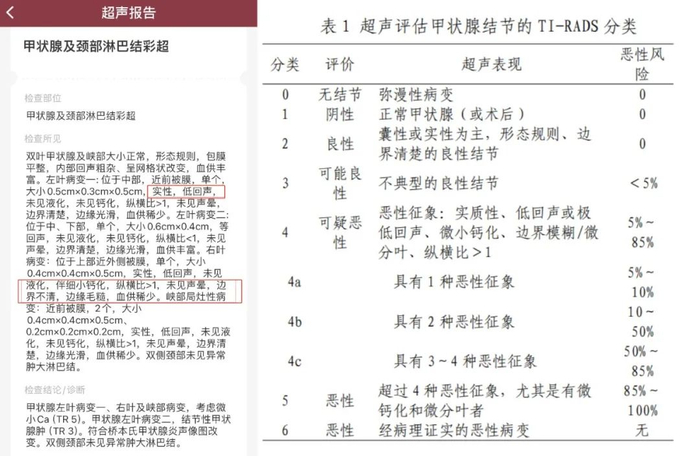 彩超结果显示的“实性”“低回声”“钙化”“边缘毛糙”都是恶性征象。图/受访者供图、《甲状腺癌诊疗指南（2022年版）》
