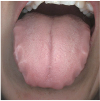 3分钟学会看舌象,提前预知身体健康状况|中医_新浪新闻