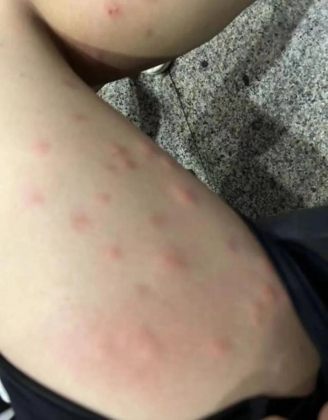 无锡情况是……|臭虫|跳蚤|无锡_新浪新闻